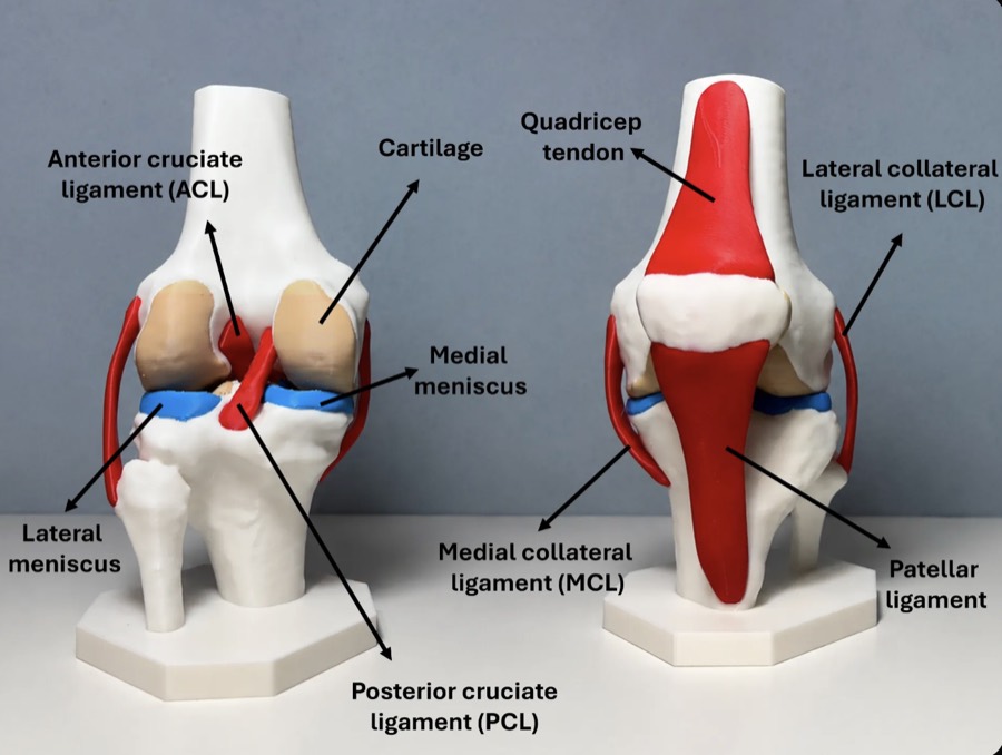 Modelo impreso en 3D de la articulación de la rodilla, vista anterior y posterior, con ligamentos en rojo, meniscos en azul y cartílago en beige